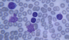 HEMATOLOGY_SMALL_IMAGE